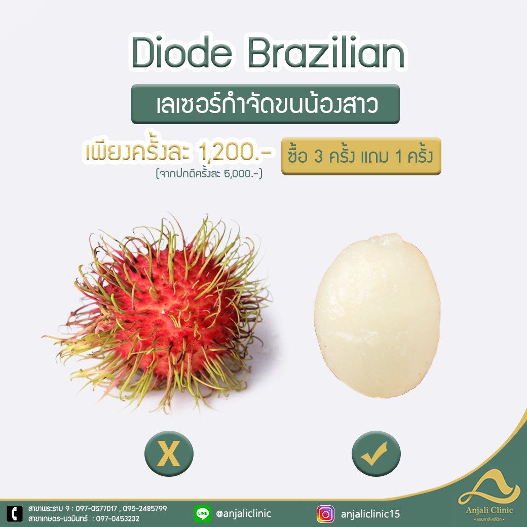 diode-brazilian